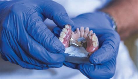 Esthetic Clasp Design for Removable Partial Dentures on Premolar Teeth 
