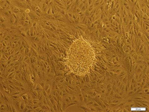 A cell line derived from the kidney of the african green (vervet) monkey, (cercopithecus aethiops) used primarily in virus replication studies and plaque assays. 78 questions with answers in VERO CELLS | Scientific method