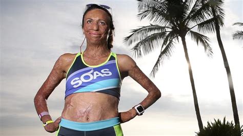 Ironman World Championship Marathon Burns Survivor Turia Pitt Takes On The World