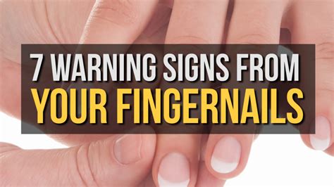 Warning Signs From Your Fingernails