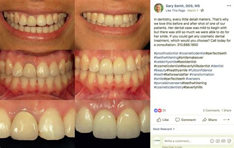 5 Simple And Effective Social Media Post For Dentists The Docsites Websites And Online Marketing