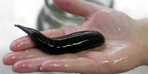 The 10 Most Horrifying Parasites That Infect Humans Therichest
