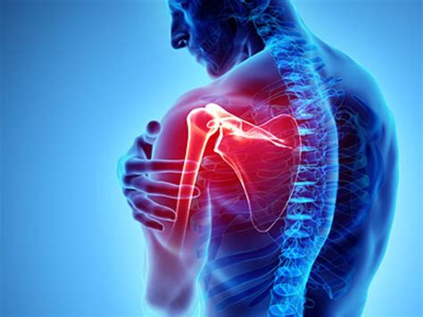 Suffering With Chronic Shoulder Pain