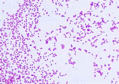Gram Negative Bacteria Images Photos Of Escherichia Coli Salmonella