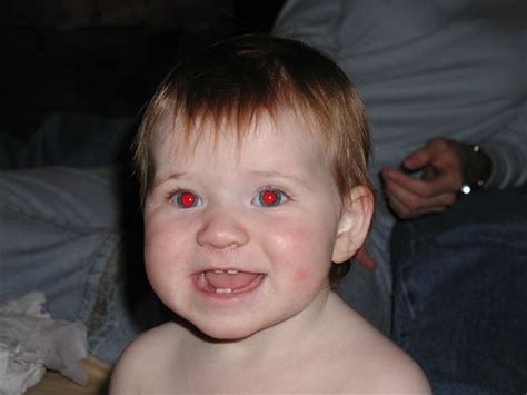 Avoiding Red Eye In Your Photos ~ Health Tips Children Health Tips