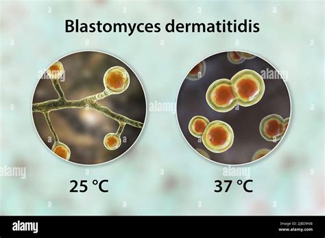Blastomyces Fungus Illustration Stock Photo Alamy