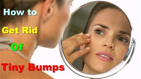 Get Rid Of Little Bumps On Forehead Get Rid Of Bumps