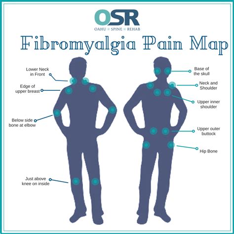 Hip Pain Fibromyalgia Signs And Symptoms The Hip Flexor