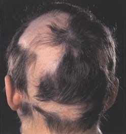 Dog hair loss is quite common as many of you dog owners will know. THE VIEW FROM FEZ: Horse Riding in Morocco - a Hair ...