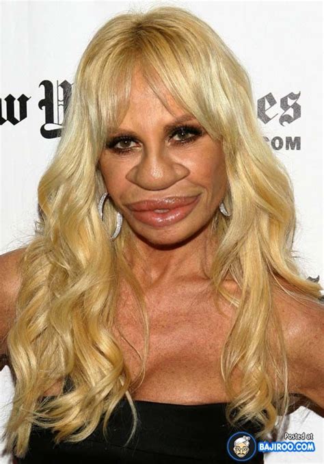 Donatella Versace With A Big Nose
