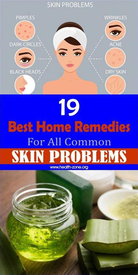 19 best home remedies for all common skin problems skin problems home remedies for skin anti