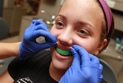 If fitting a mouthguard at home, you're probably using the boil and bite method. Should my Child Wear a Mouthguard while Playing Sports?