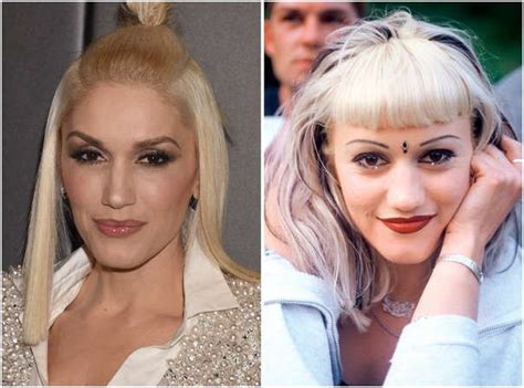 Has Gwen Stefani Had Plastic Surgery