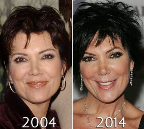 Kris Jenner Nosejob Before And After Photo Kris Jenner Haircut Kris