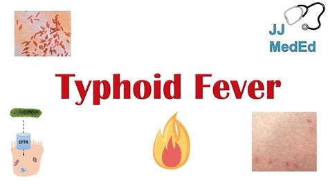 Typhoid Fever Pathogenesis Vectors Bacteria Symptoms Diagnosis