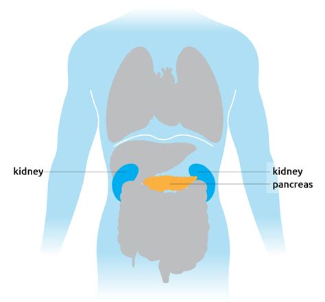 Torso Kidney Pancreas Transplant Living