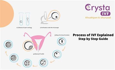 Process Of Ivf Explained Step By Step Guide