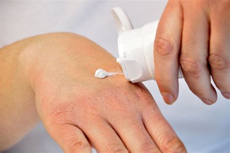 How To Treat And Prevent Eczema Flare Ups Popsugar Beauty Uk