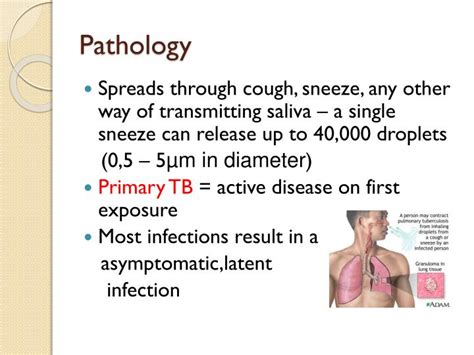 Ppt Pulmonary Tuberculosis Powerpoint Presentation Id1945699