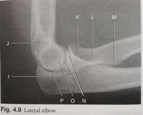 Lateral Elbow Diagram Quizlet