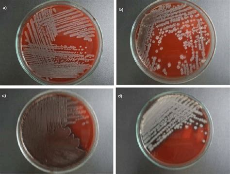 Cultivo De Especies De Bacillus En Agar Sangre A B Licheniformis