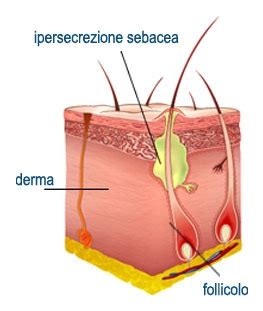 Ghiandola sebacea e sebo | Centro Tricologico Dermes