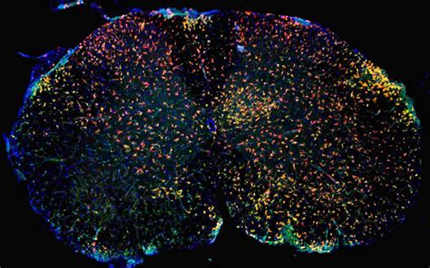 Newly Discovered Immune Cells Play Role In Inflammatory Brain Diseases