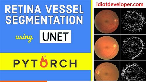Retina Blood Vessel Segmentation Using Unet In Pytorch Image My Xxx Hot Girl