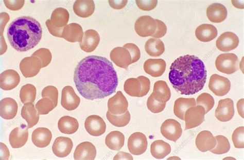 Normal Blood Smear Lm Stock Image C0222204 Science Photo Library