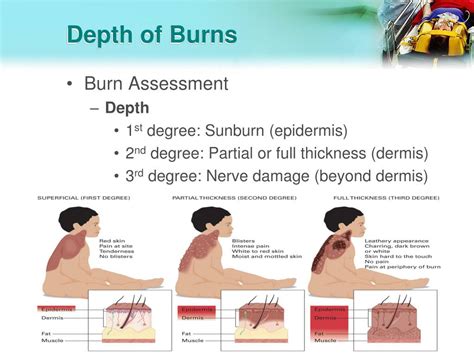 Ppt Pediatric Trauma Skills Lab Powerpoint Presentation Free