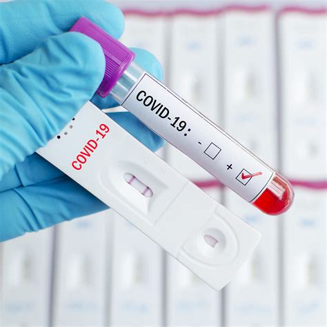 Бързи тестове за антитела за коронавирус - Болница 