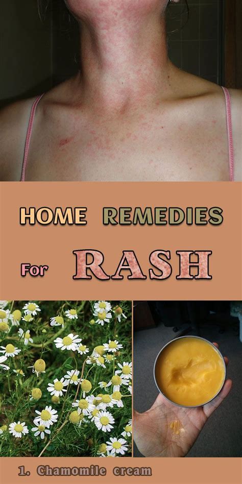 Natural Treatments Against Rash Natural Treatments Home Remedies For