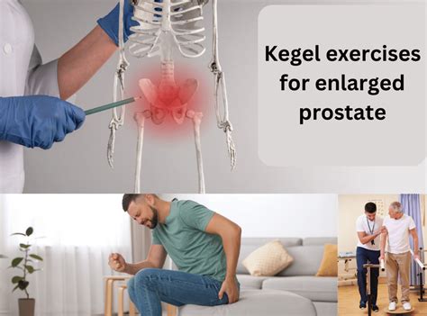 Kegel Exercises For Enlarged Prostate