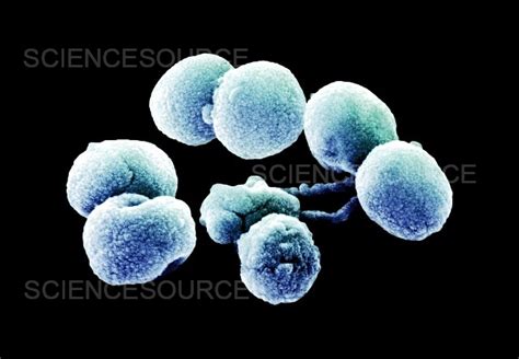 Photograph Streptococcus Pneumoniae Bacteria SEM Science Source Images