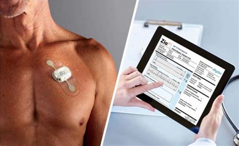 Heart Holter Monitoring To Diagnose Palpitations Get Help