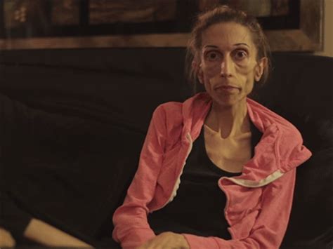 Anorexic Actress Rachael Farrokh Told By Hospitals She Is Too Skinny To