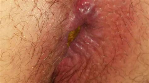 Young Dude Pooping Close Up 23 Yo 2 Gay Scat Porn At