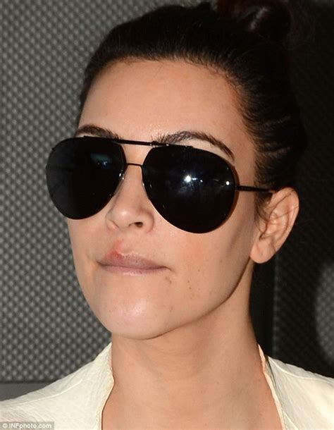 Kim Kardashian Reveals Painful Looking Sore On Her Lip As She Flies