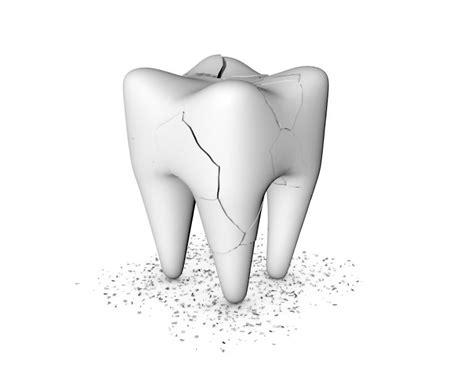 What Are The Signs And Symptoms And Treatments For A Cracked Tooth