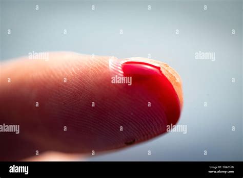 Finger Cut Bleeding Injured With Knife Flesh Blood Wound In Hand