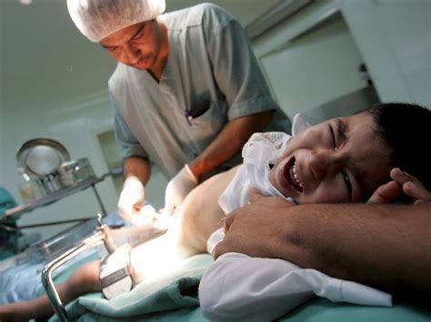 Beschneidung Mann Heilung Full Circumcision Related Keywords Suggestions Full Circ