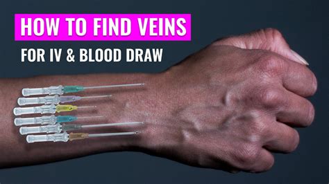 How To Find A Vein Nursing Phlebotomy Vein Finder Finding Vein