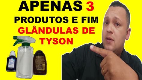 IncrÍvel 3 Produtos E Remova Suas Glândulas De Tyson As Bolinhas Brancas Em 7 Dias Youtube