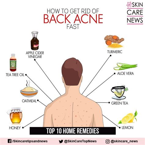 How To Get Rid Of Back Acne Fast Skin Care Top News