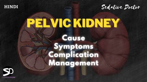 Pelvic Kidney Nephroptosis Cause Symptoms Treatment Sedative