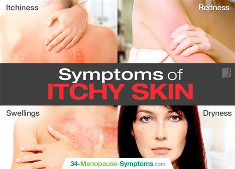 Symptoms Of Itchy Skin Itchy Skin Itchy Skin Treatment Severe Itchy