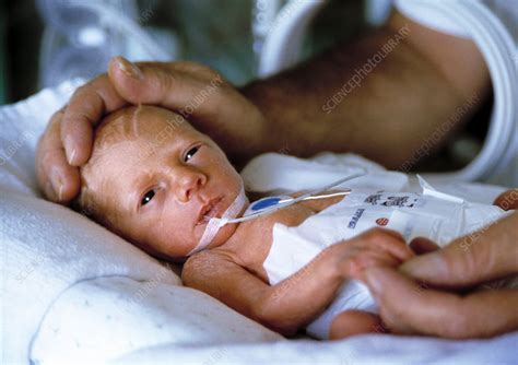 Premature Baby Stock Image M8200401 Science Photo Library