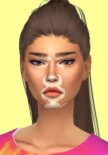 Sims4 Only Sims Mods Sims 4 Cc Skin Vitiligo