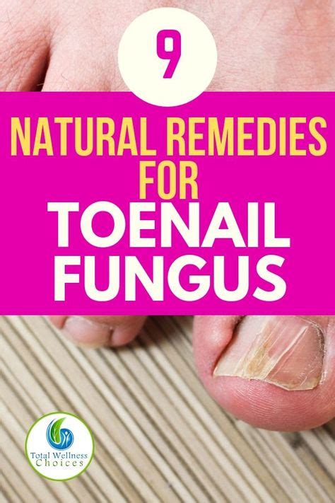 9 Best Natural Home Remedies For Toenail Fungus Natural Toenail