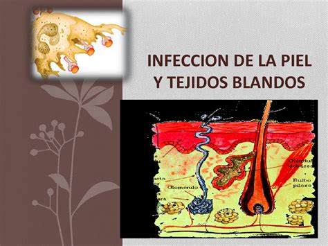 Solution Infeccion De La Piel Y Tejidos Blandos Studypool